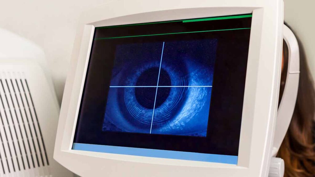 Diabetes eye scans